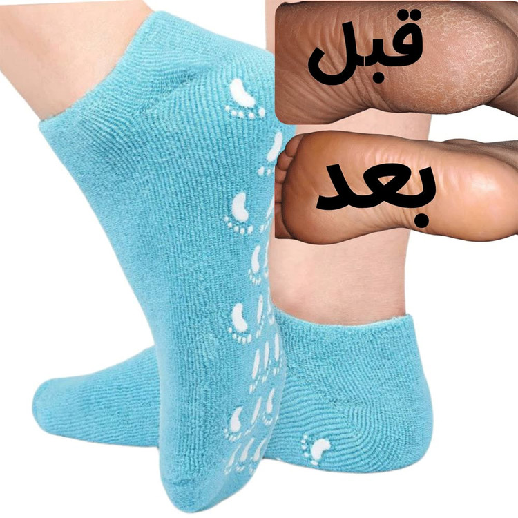 جوراب سیلیکونی رفع ترک پا - قبل و بعد